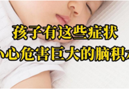 【科普一下】孩子有这些症状，小心危害巨大的脑积水